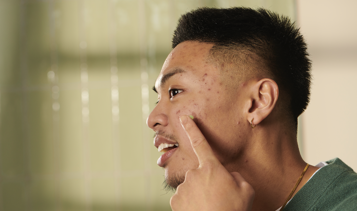 Pánska starostlivosť o pleť Pánska starostlivosť o pleť